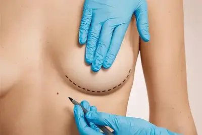 chirurgie des seins en tunisie