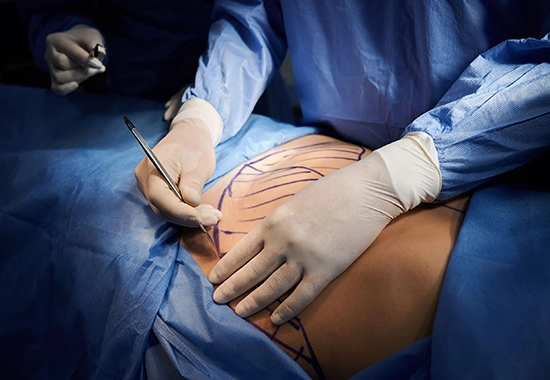 Déroulement de l’Intervention