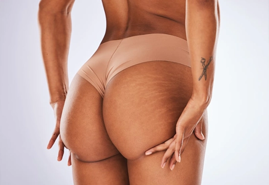 Avantages du BBL en Tunisie