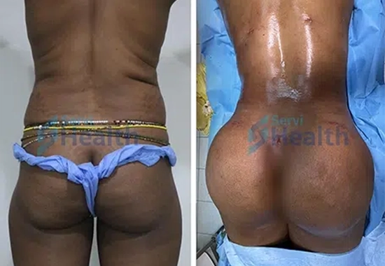 Résultats et Satisfaction