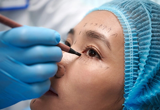 Déroulement de l’Intervention